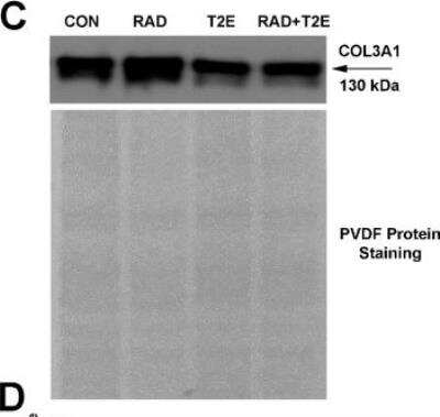 Western Blot: Collagen III alpha 1/COL3A1 Antibody [NB600-594]