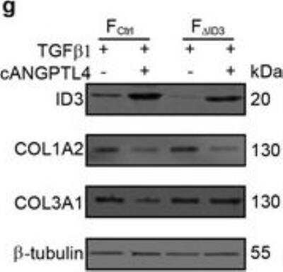 Western Blot: Collagen III alpha 1/COL3A1 Antibody [NB600-594]