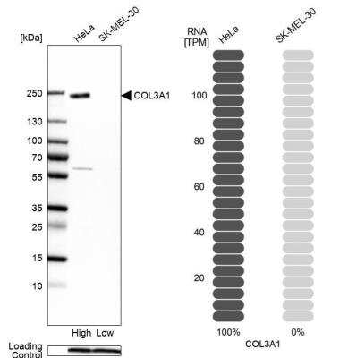 Western Blot: Collagen III alpha 1/COL3A1 Antibody [NBP1-84007]