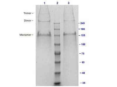 SDS-PAGE: Collagen III alpha 1/COL3A1 Native Protein [NBP1-97244]