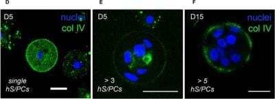 Immunocytochemistry/ Immunofluorescence: Collagen IV Antibody (1043) - BSA Free [NBP1-97716]