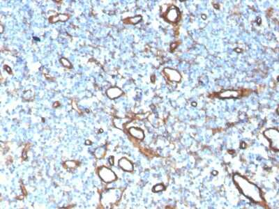 Immunohistochemistry-Paraffin: Collagen IV Antibody (COL4/4241R) - Azide and BSA Free [NBP3-08277]