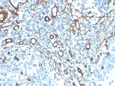 Immunohistochemistry-Paraffin: Collagen IV Antibody (COL4/4241R) - Azide and BSA Free [NBP3-08277]
