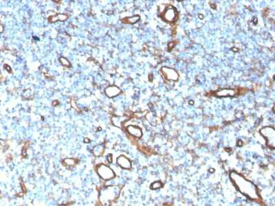 Immunohistochemistry-Paraffin: Collagen IV Antibody (COL4/4241R) [NBP3-07750]
