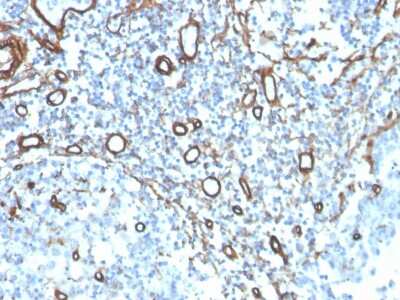 Immunohistochemistry-Paraffin: Collagen IV Antibody (COL4/4241R) [NBP3-07750]