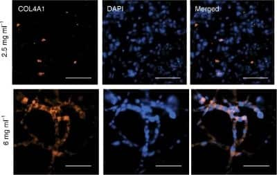 Immunocytochemistry/ Immunofluorescence: Collagen IV Antibody [NB120-6586]