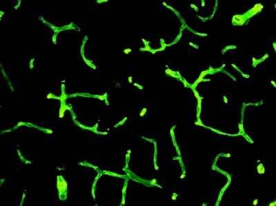 Immunohistochemistry-Frozen: Collagen IV Antibody [NB120-6586]