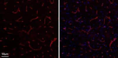 Immunohistochemistry-Frozen: Collagen IV Antibody [NBP1-26549]