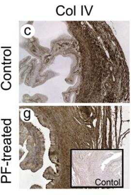 Immunohistochemistry: Collagen IV Antibody [NBP1-26549]