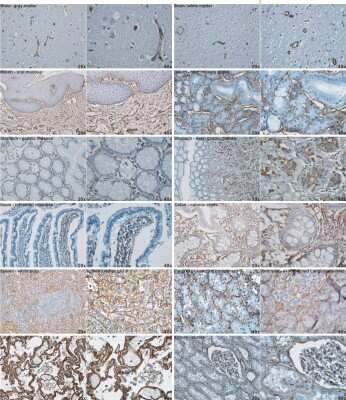 Immunohistochemistry-Paraffin: Collagen IV Antibody [NB120-6586]