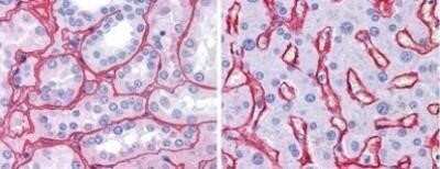 Immunohistochemistry-Paraffin: Collagen IV Antibody [NB120-6586]