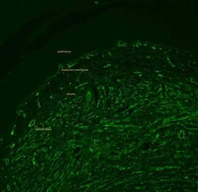 Immunohistochemistry-Paraffin: Collagen IV Antibody [NB120-6586]