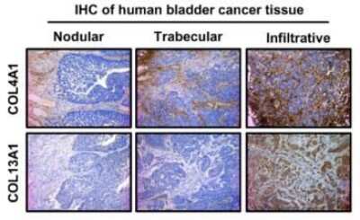 Immunohistochemistry-Paraffin: Collagen IV Antibody [NB120-6586]