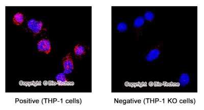 Knockout Validated: Collagen IV Antibody [NB120-6586]