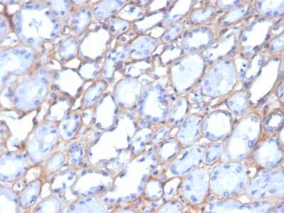 Immunohistochemistry-Paraffin: Collagen IV Antibody (M3F7) - Azide and BSA Free [NBP3-08515]
