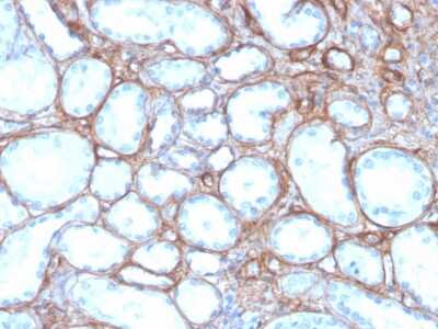 Immunohistochemistry-Paraffin: Collagen IV Antibody (rCOL4/4742) - Azide and BSA Free [NBP3-08487]