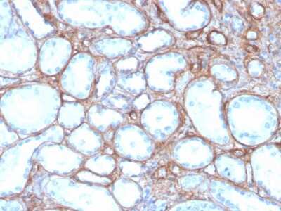 Immunohistochemistry-Paraffin: Collagen IV Antibody (rCOL4/4742) [NBP3-07596]