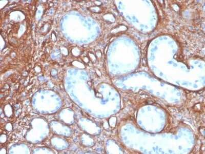 Immunohistochemistry-Paraffin: Collagen IV Antibody (rCOL4/4742) [NBP3-07596]