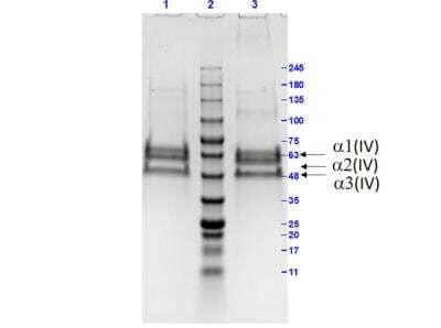 SDS-PAGE: Collagen IV Native Protein [NBP1-97245]