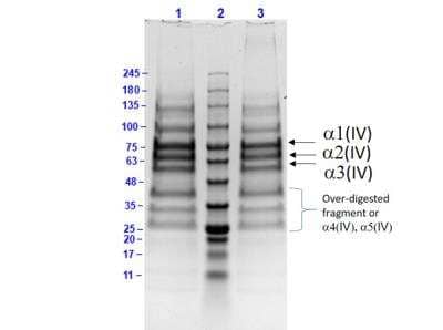 SDS-PAGE: Collagen IV Native Protein [NBP1-97268]