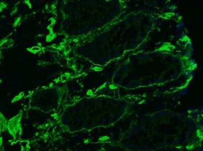 Immunohistochemistry-Frozen: Collagen IV Antibody (1043) - BSA Free [NBP1-97716]