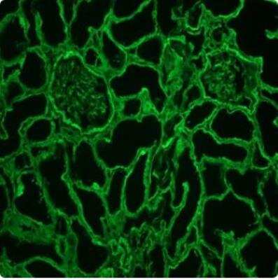 Immunohistochemistry-Frozen: Collagen IV Antibody (1043) - BSA Free [NBP1-97716]