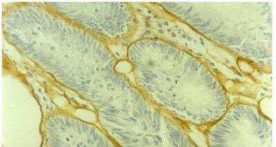 Immunohistochemistry-Paraffin: Collagen IV Antibody (1043) - BSA Free [NBP1-97716]