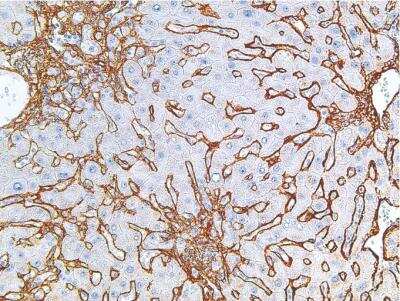 Immunohistochemistry-Paraffin: Collagen IV Antibody (IHC549) [NBP2-75982]