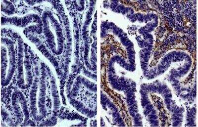 Immunohistochemistry-Paraffin: Collagen IV Antibody [NBP1-26549]