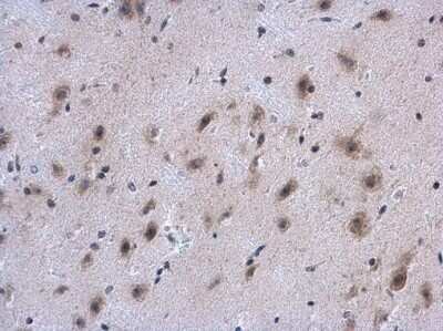 Immunohistochemistry-Paraffin: Collagen IV alpha 1 Antibody [NBP3-12908]