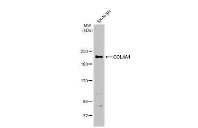 Western Blot: Collagen IV alpha 1 Antibody [NBP3-12908]