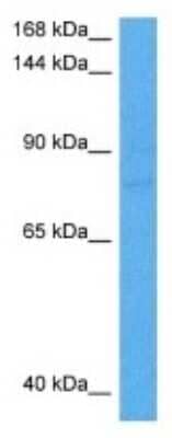 Western Blot: Collagen IV alpha5 Antibody [NBP3-10797]