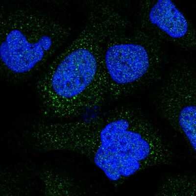 Immunocytochemistry/ Immunofluorescence: Collagen IX alpha 2 Antibody [NBP2-30450]