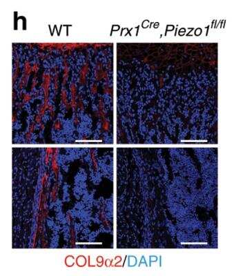 Immunohistochemistry: Collagen IX alpha 2 Antibody [NBP2-30450]