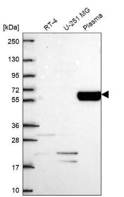 Western Blot: Collagen IX alpha 2 Antibody [NBP2-69005]