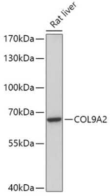 Western Blot: Collagen IX alpha 2 AntibodyAzide and BSA Free [NBP2-92360]