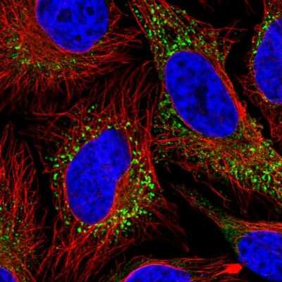 Immunocytochemistry/ Immunofluorescence: Collagen V Antibody [NBP2-38162]