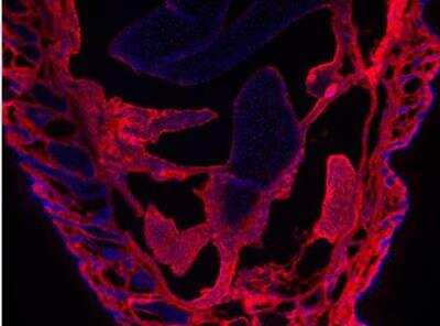Immunohistochemistry-Frozen: Collagen V Antibody [NBP1-26551]