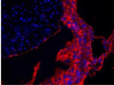 Immunohistochemistry-Frozen: Collagen V Antibody [NBP1-26551]