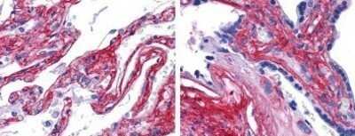 Immunohistochemistry-Paraffin: Collagen V Antibody [NB120-7046]