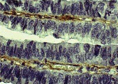 Immunohistochemistry-Paraffin: Collagen V Antibody [NBP1-26551]