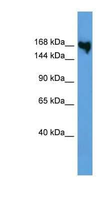 Western Blot: Collagen V Antibody [NBP1-68938]