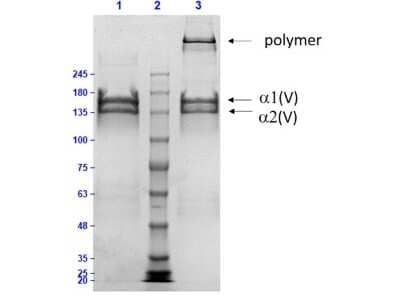 SDS-PAGE: Collagen V Native Protein [NBP1-97269]