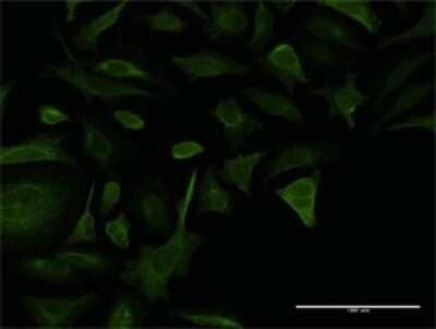 Immunocytochemistry/ Immunofluorescence: Collagen V alpha 2 Antibody (3G11) [H00001290-M02]