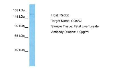 Western Blot: Collagen V alpha 2 Antibody [NBP2-83978]