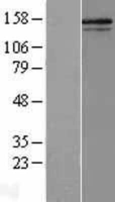 Western Blot: Collagen V alpha 2 Overexpression Lysate [NBL1-09355]