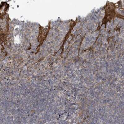 Immunohistochemistry-Paraffin: Collagen V alpha 3 Antibody [NBP2-48899]