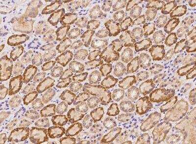 Immunohistochemistry-Paraffin: Collagen V alpha 3 Antibody [NBP3-05942]