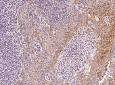 Immunohistochemistry-Paraffin: Collagen V alpha 3 Antibody [NBP3-05942]