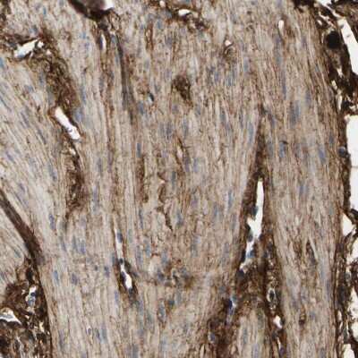 Immunohistochemistry-Paraffin: Collagen VI alpha 1 Antibody [NBP1-91195]